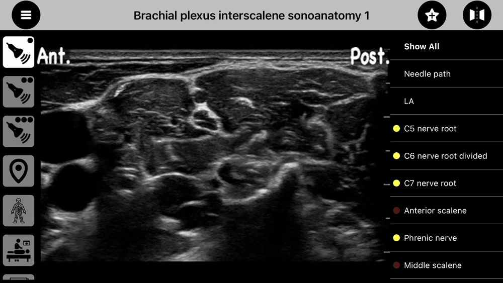 AnSo Anaesthesia Sonoanatomy Google Play pantalla 3 de 10 (store): Google Play